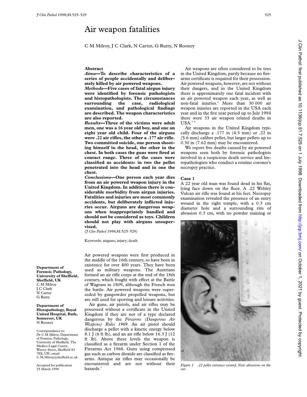 Air Weapon Fatalities J Clin Pathol: First Published As 10.1136/Jcp.51.7.525 on 1 July 1998