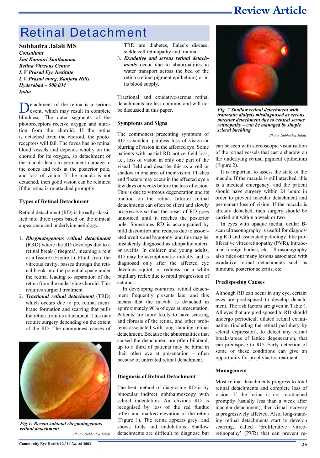 Retinal Detachment Subhadra Jalali MS TRD Are Diabetes, Eales’S Disease, Consultant Sickle Cell Retinopathy and Trauma