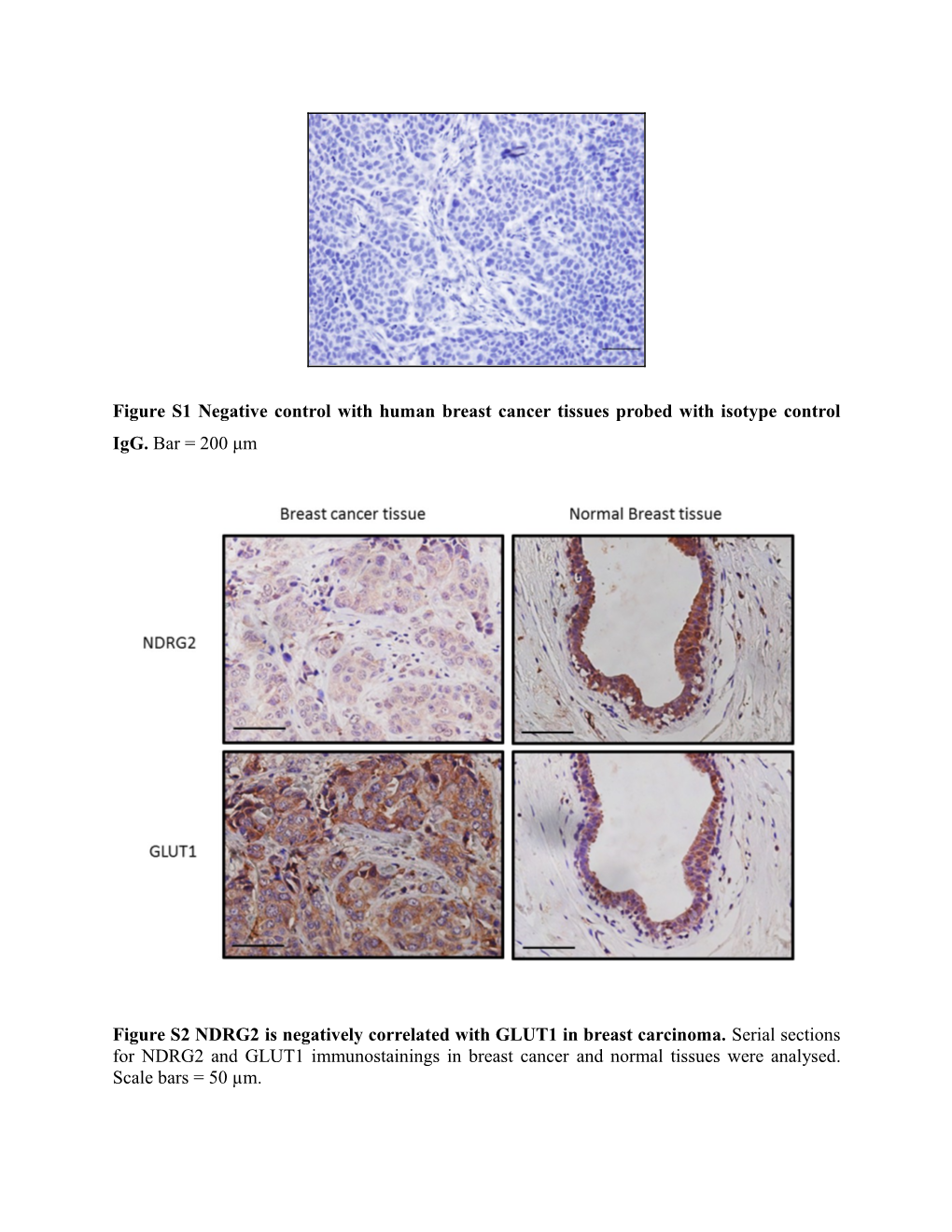 Figure S1 Negative Control with Human Breast Cancer Tissues Probed with Isotype Control