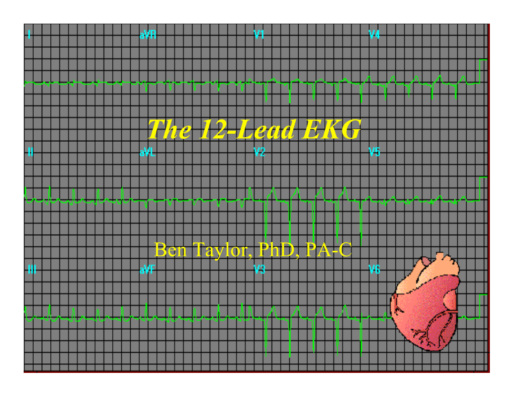 12-Lead EKG.Ppt [Read-Only]