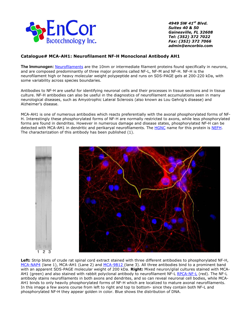 Encor Biotechnology Inc