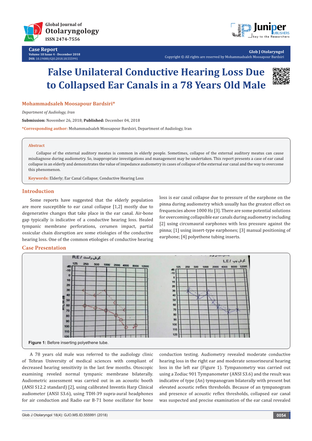 False Unilateral Conductive Hearing Loss Due to Collapsed Ear Canals in a 78 Years Old Male