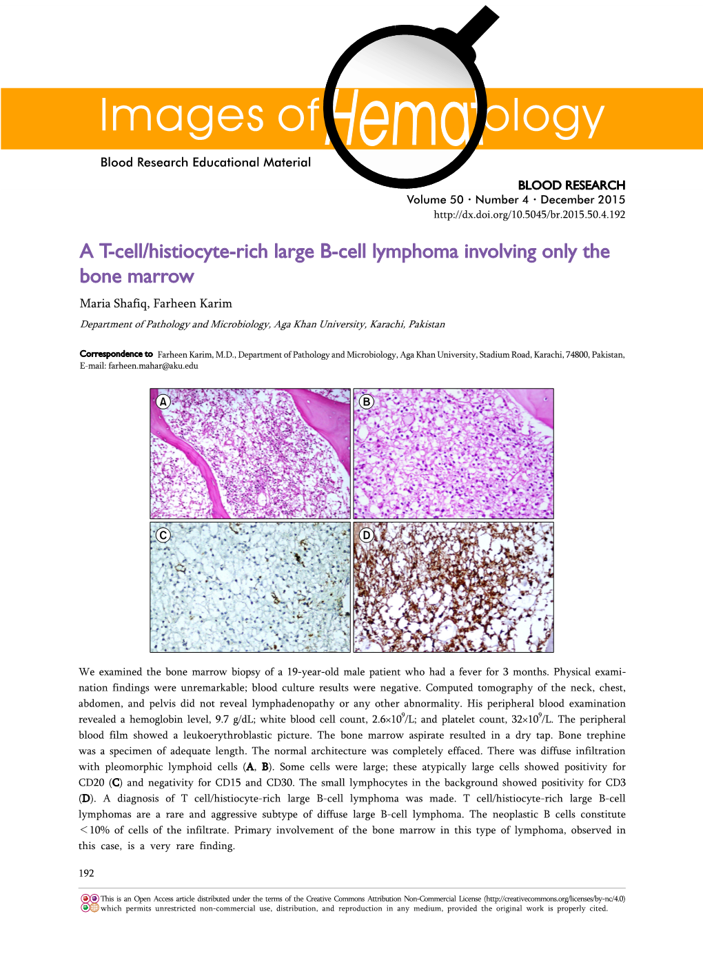 A T-Cell/Histiocyte-Rich Large B-Cell Lymphoma Involving Only the Bone