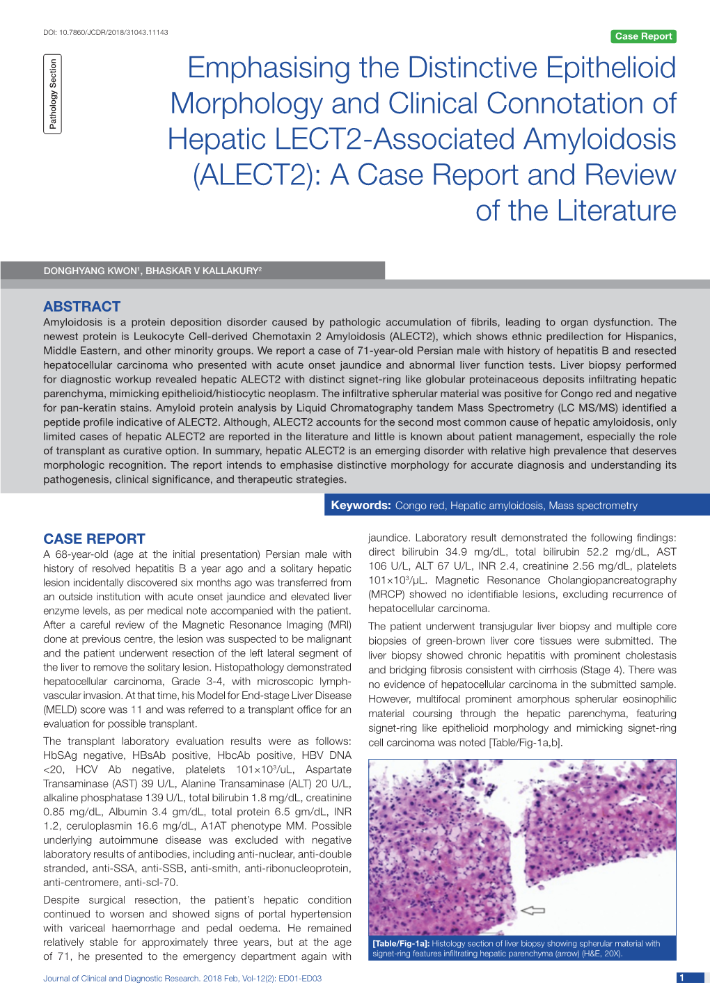 Emphasising the Distinctive Epithelioid Morphology and Clinical Connotation of Hepatic LECT2-Associated Amyloidosis (ALECT2): A