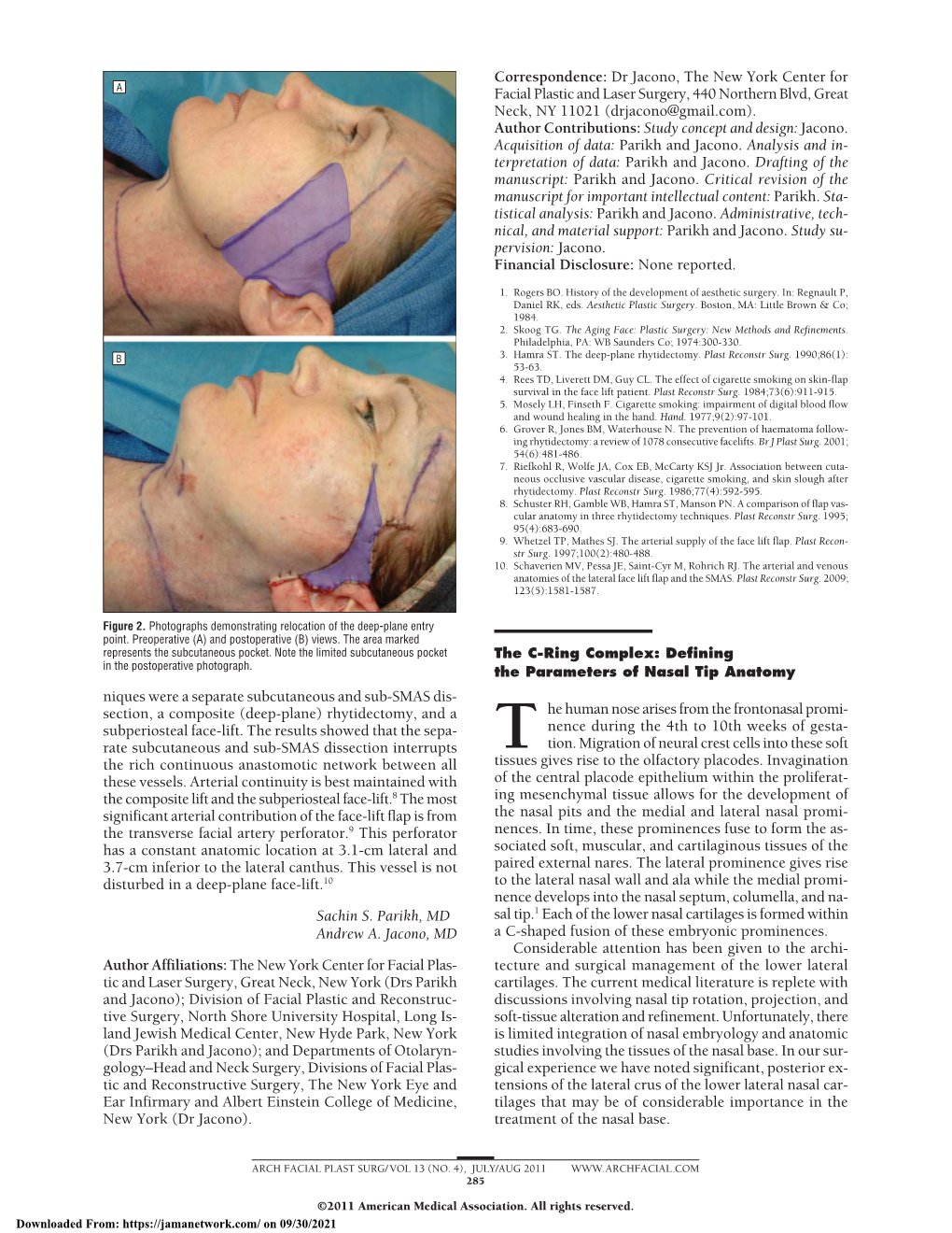 Defining the Parameters of Nasal Tip Anatomy