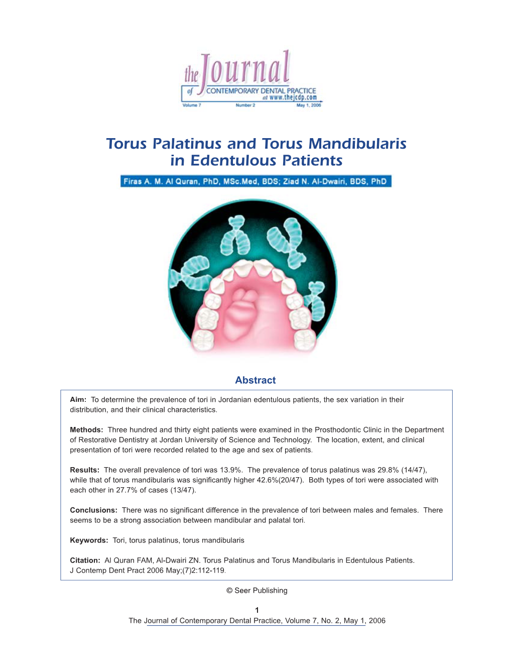 Torus Palatinus and Torus Mandibularis in Edentulous Patients