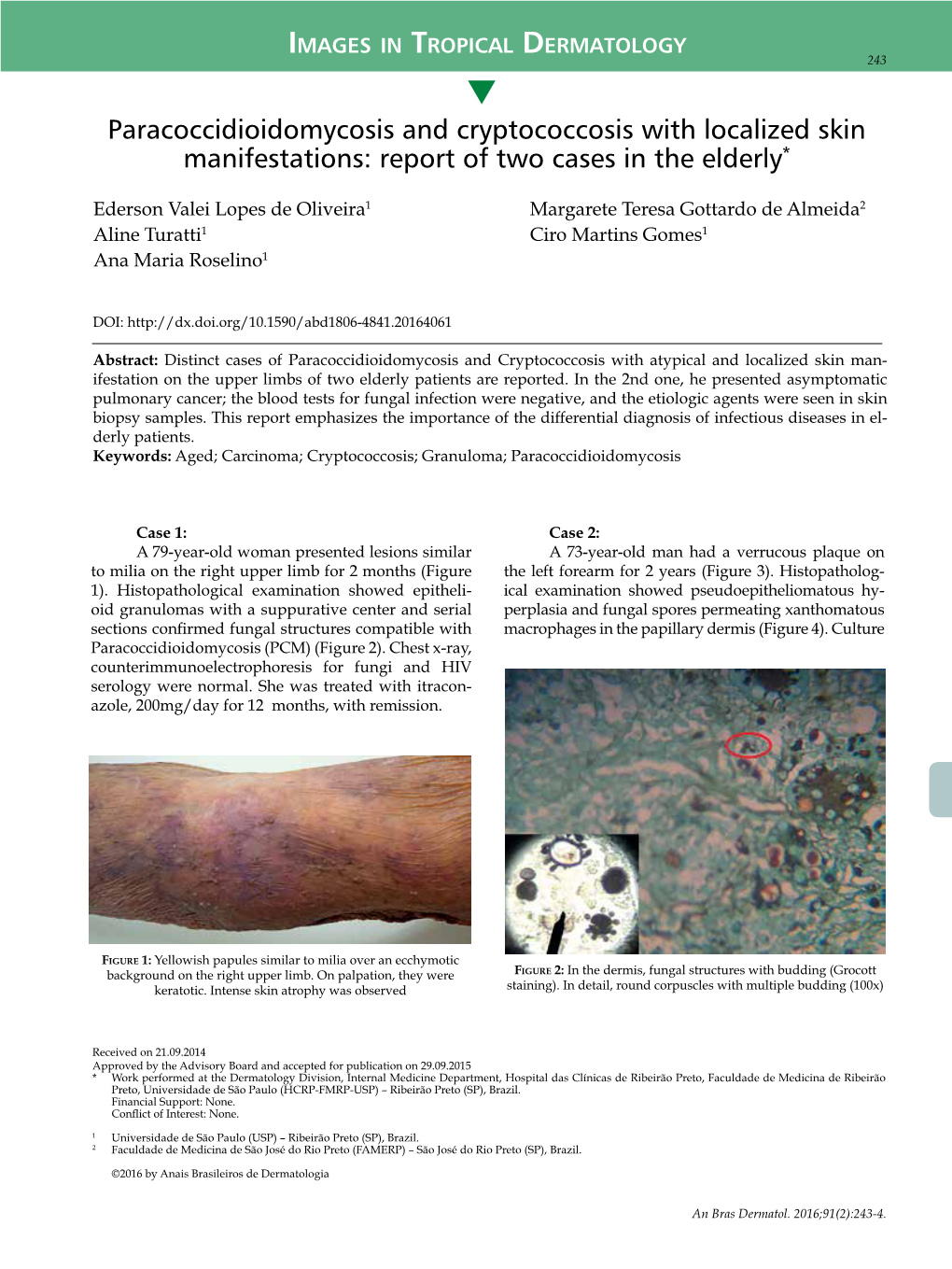 Paracoccidioidomycosis and Cryptococcosis with Localized Skin Manifestations: Report of Two Cases in the Elderly*