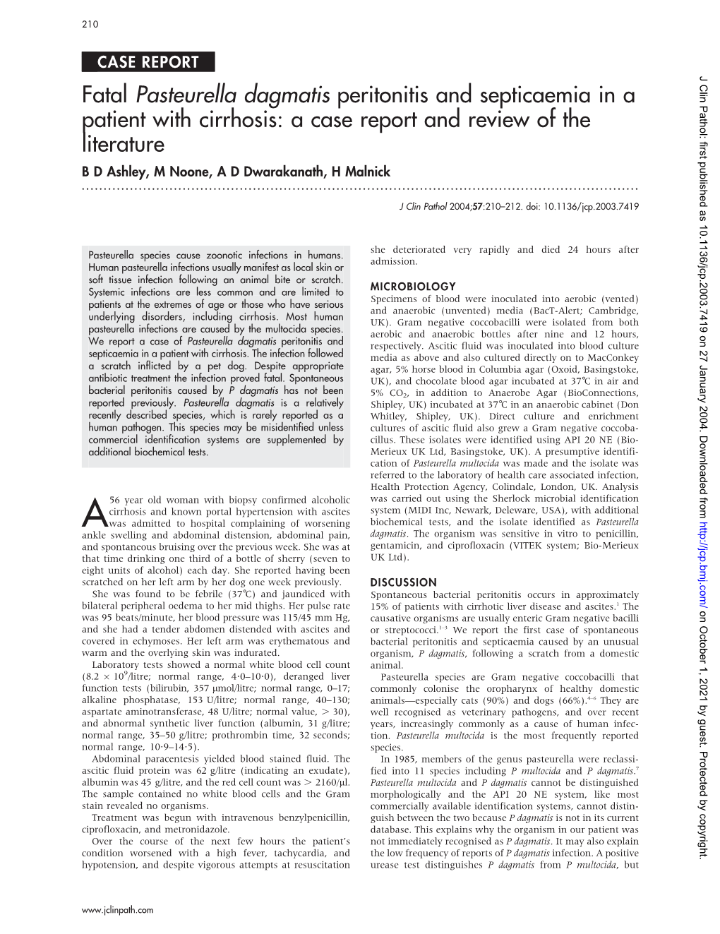 Fatal Pasteurella Dagmatis Peritonitis and Septicaemia in a Patient With