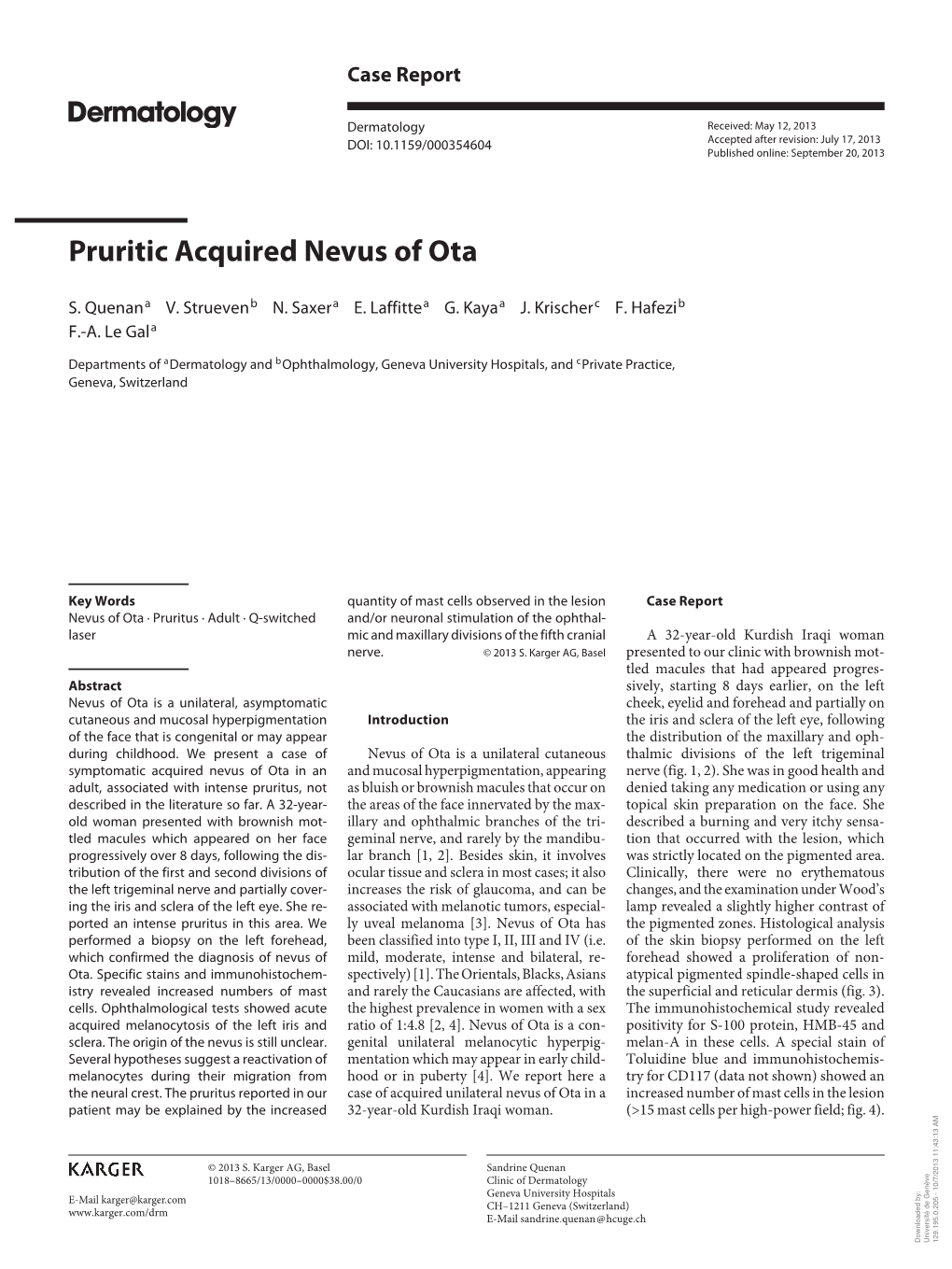 Nevus of Ota in an and Mucosal Hyperpigmentation, Appearing Nerve ( Fig