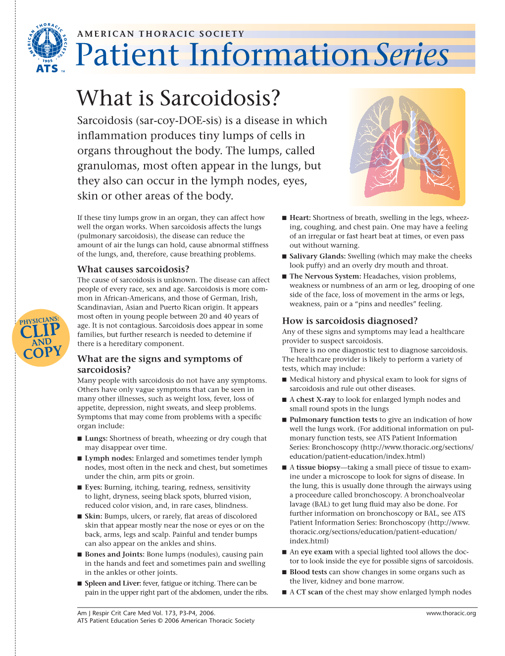 What Is Sarcoidosis? Sarcoidosis (Sar-Coy-DOE-Sis) Is a Disease in Which Inﬂammation Produces Tiny Lumps of Cells in Organs Throughout the Body