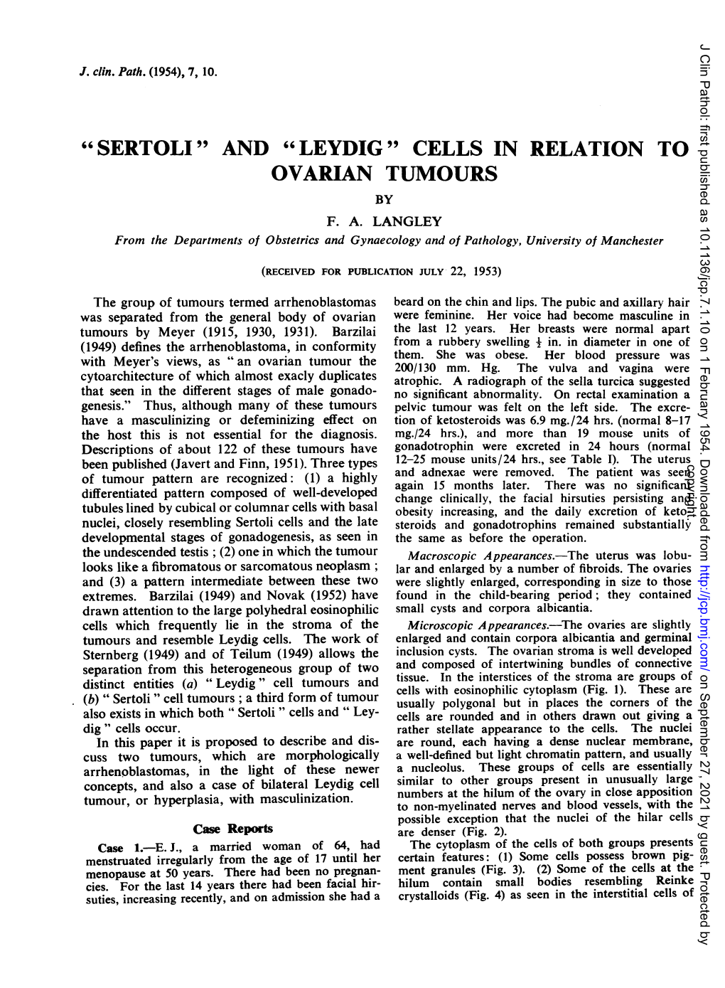 "Sertoli" and "Leydig" Cells in Relation to Ovarian Tumours by F