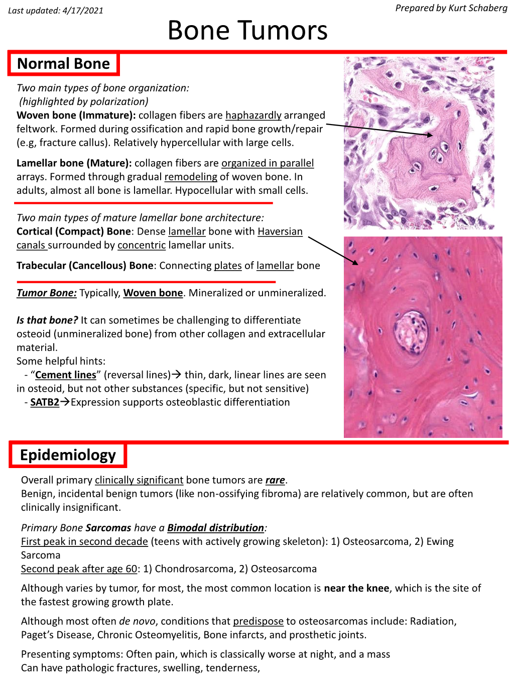 Bone Tumors Normal Bone Two Main Types of Bone Organization: (Highlighted by Polarization) Woven Bone (Immature): Collagen Fibers Are Haphazardly Arranged Feltwork