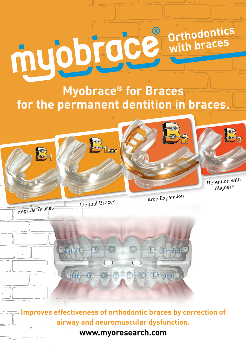 Myobrace® for Braces for the Permanent Dentition in Braces