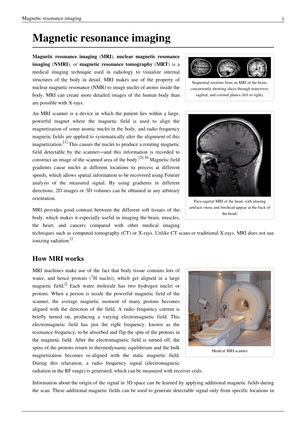 Magnetic Resonance Imaging 1 Magnetic Resonance Imaging