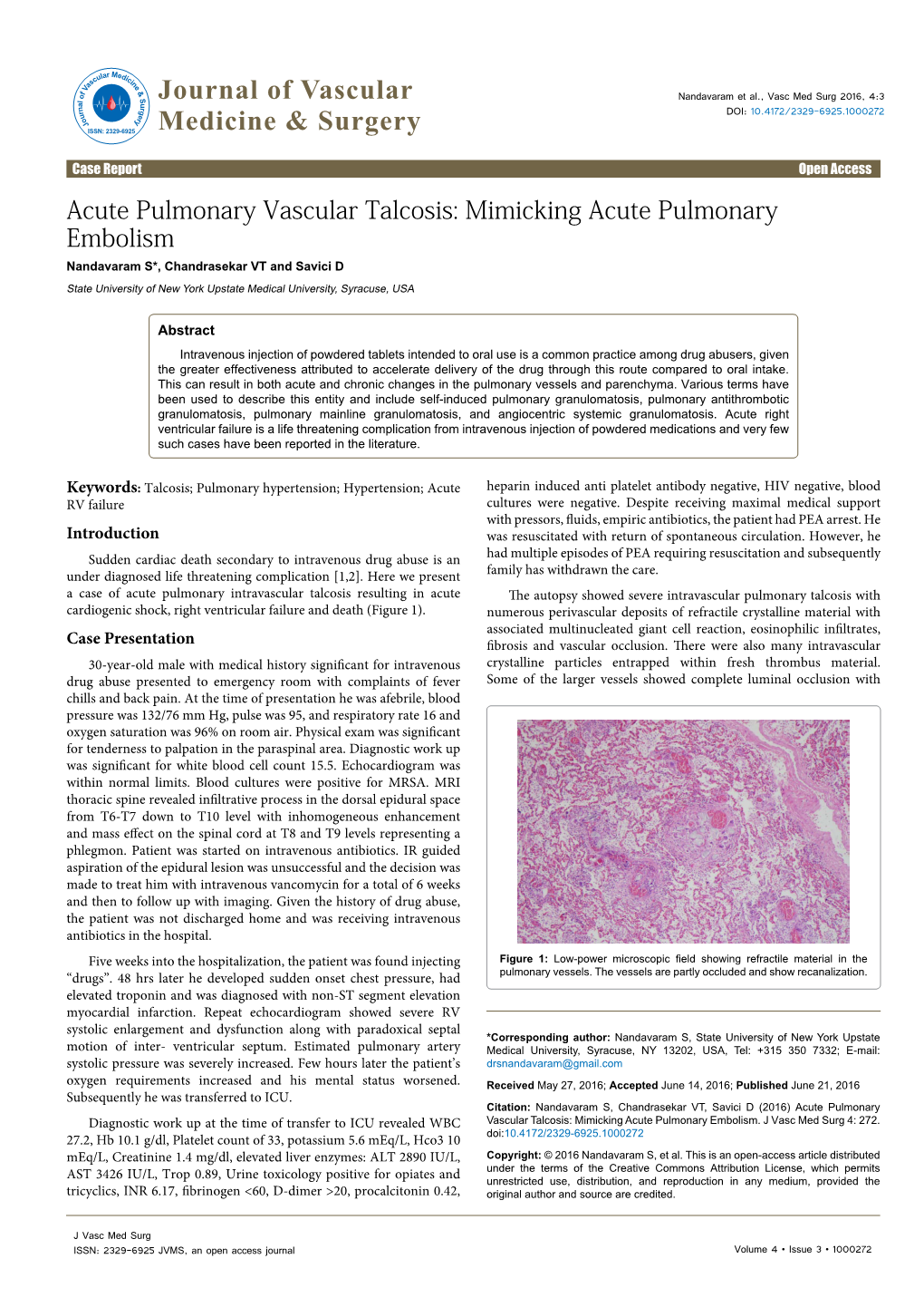 Acute Pulmonary Vascular Talcosis