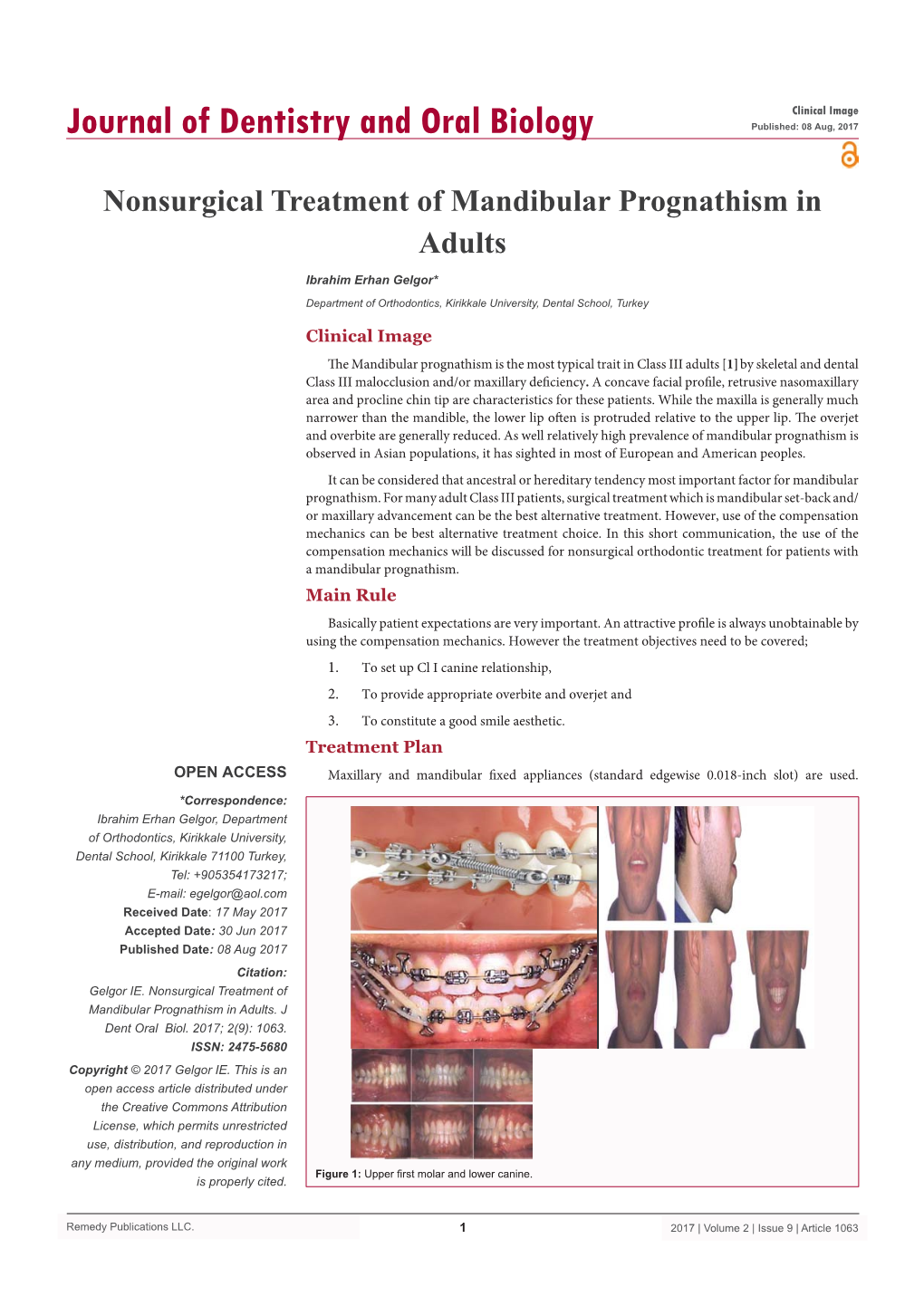 Nonsurgical Treatment of Mandibular Prognathism in Adults