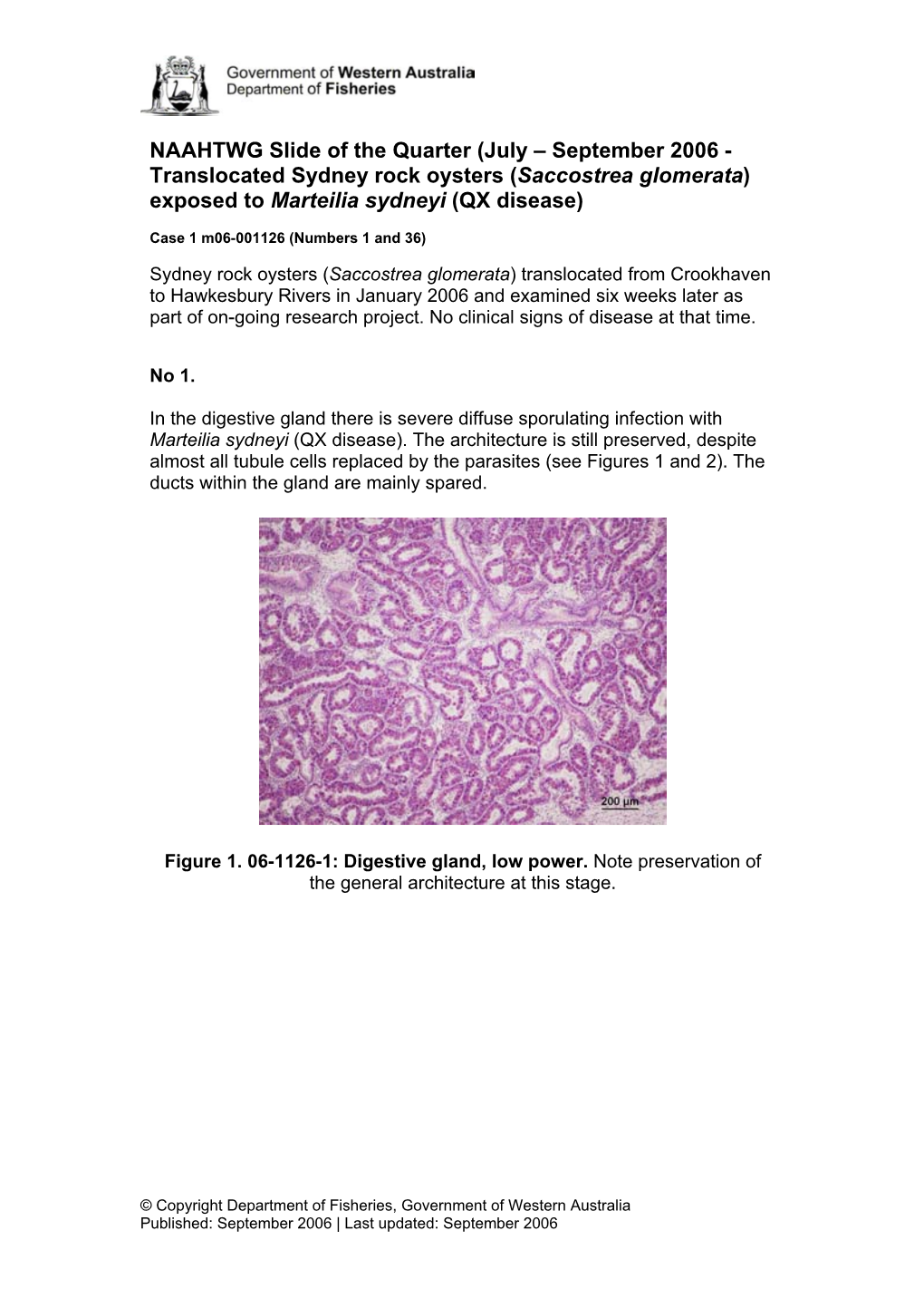 Saccostrea Glomerata) Exposed to Marteilia Sydneyi (QX Disease)