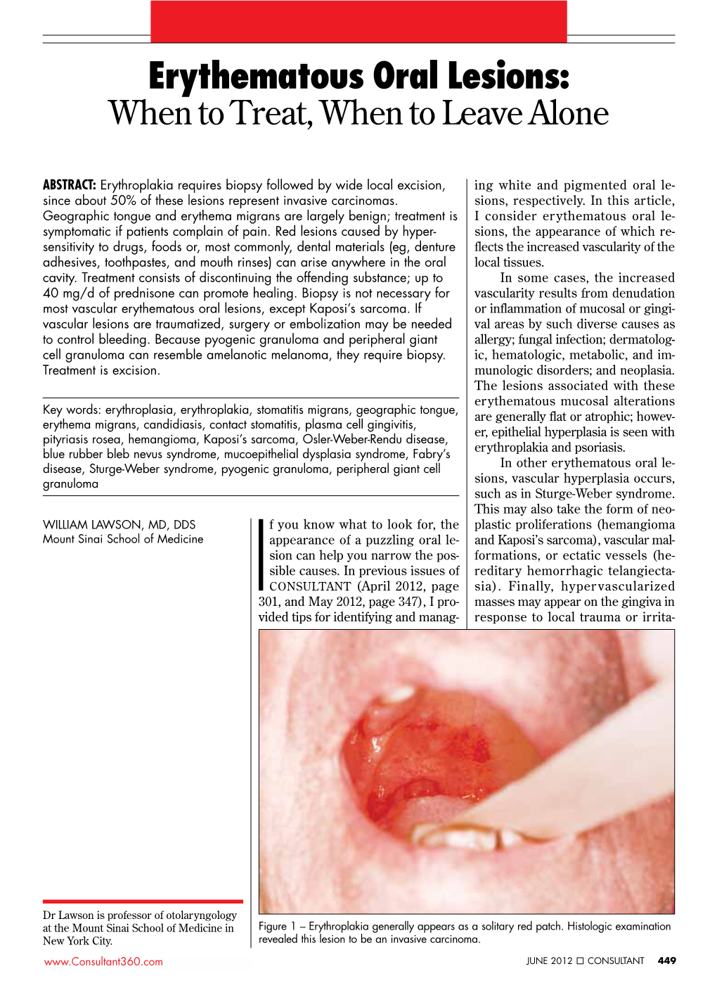 Erythematous Oral Lesions: When to Treat, When to Leave Alone