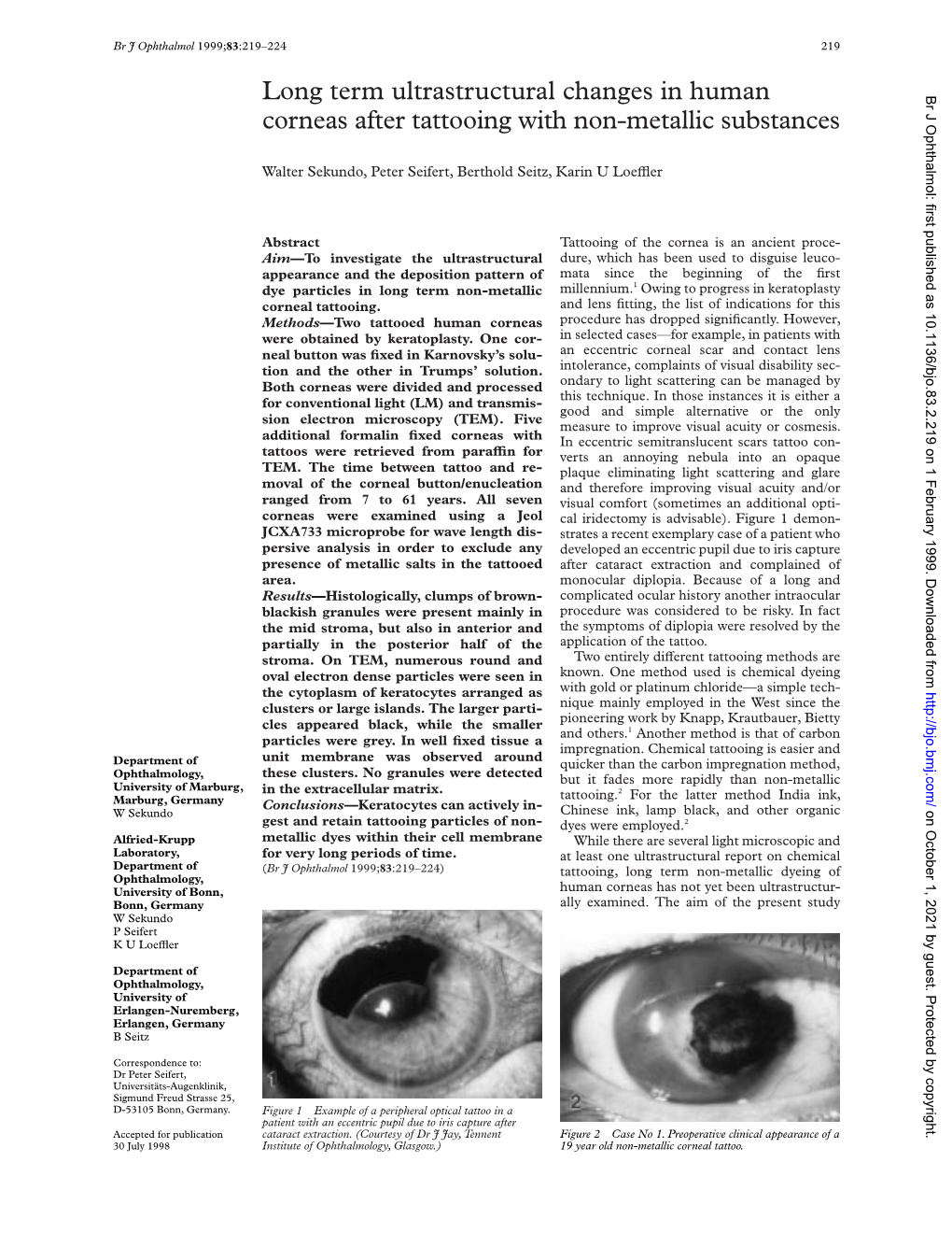 Long Term Ultrastructural Changes in Human Corneas After Tattooing with Non-Metallic Substances