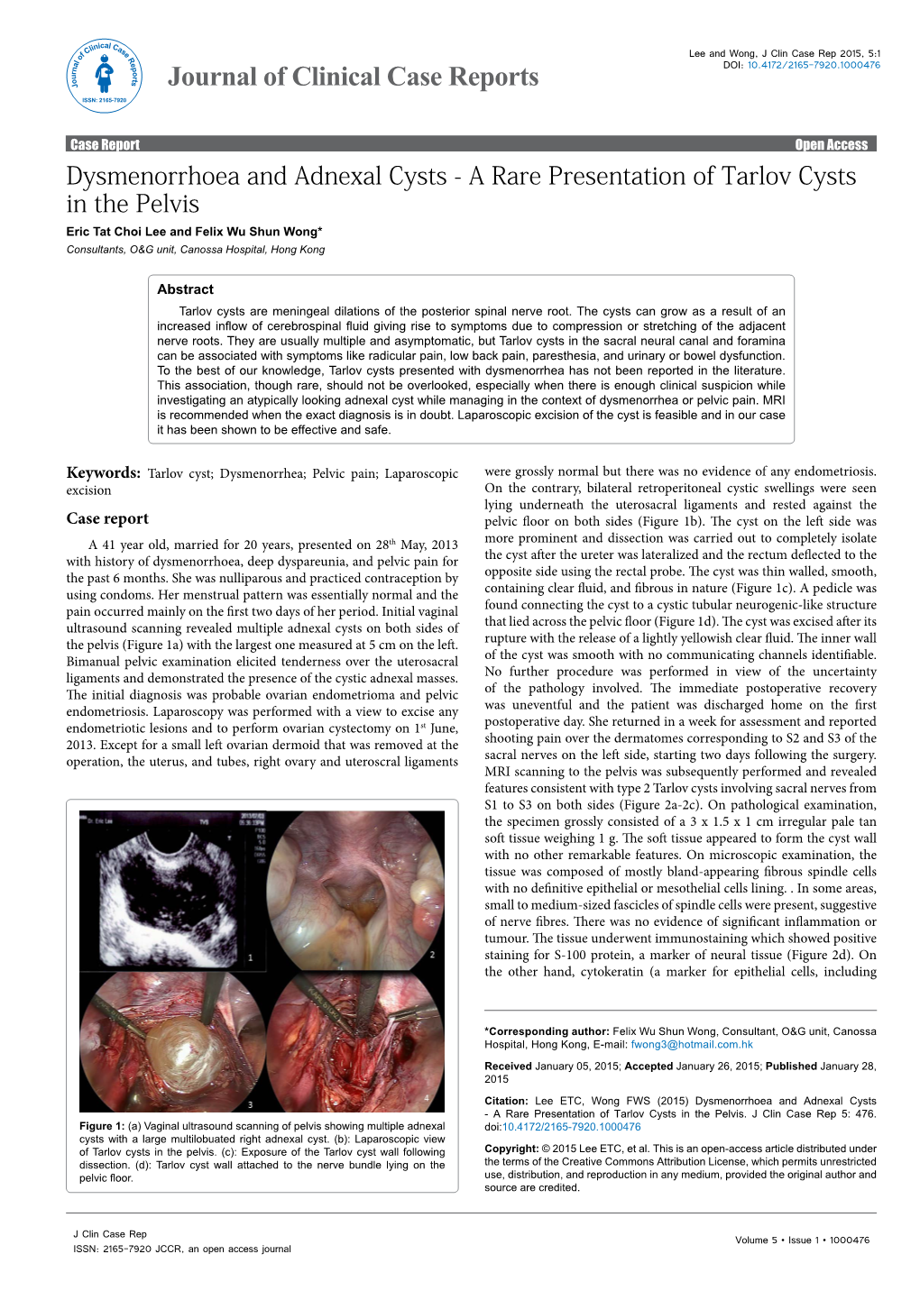 A Rare Presentation of Tarlov Cysts in the Pelvis Eric Tat Choi Lee and Felix Wu Shun Wong* Consultants, O&G Unit, Canossa Hospital, Hong Kong