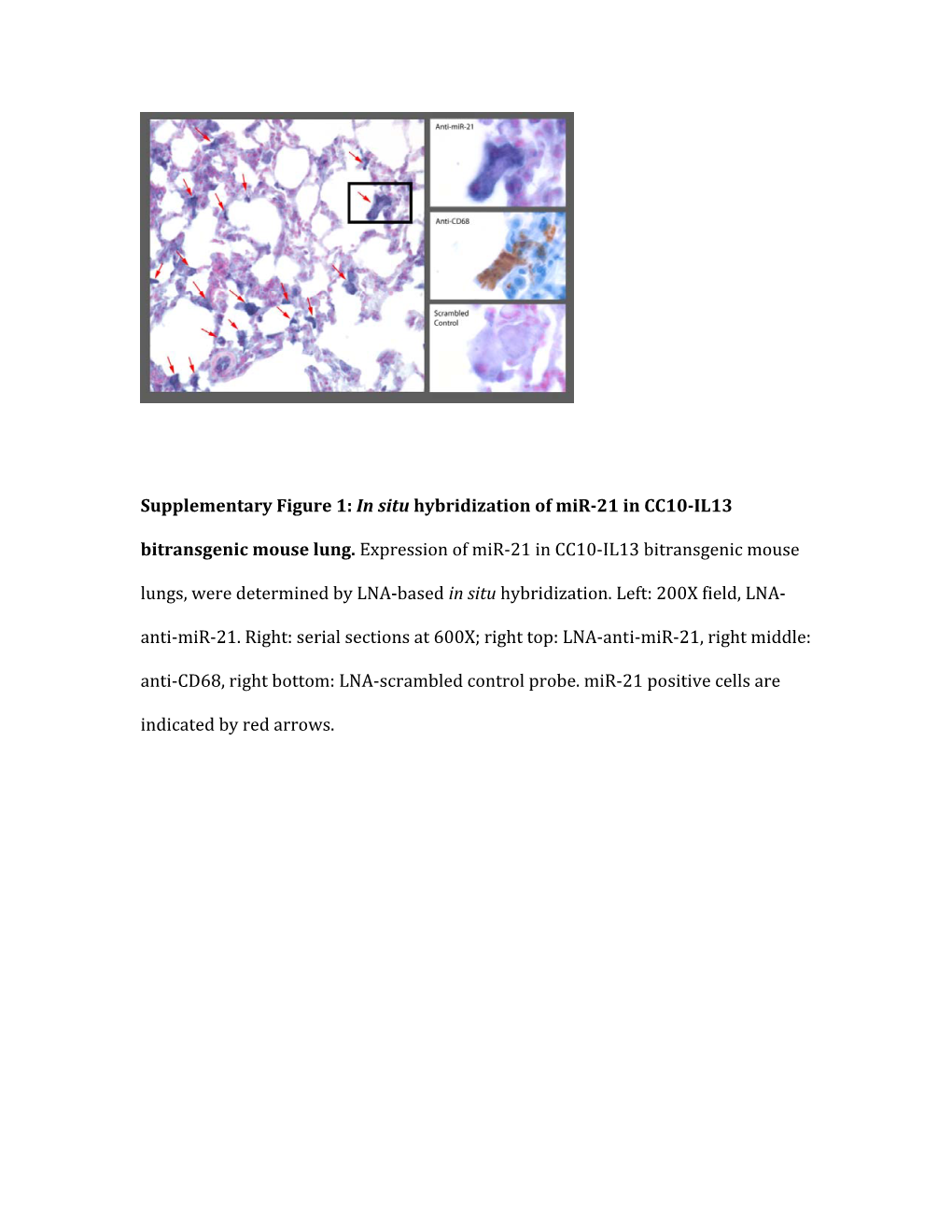Supplementary Figure 1: in Situ Hybridization of Mir-21 in CC10-IL13 Bitransgenic Mouse Lung