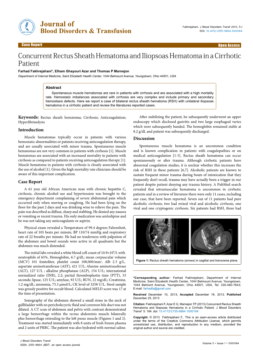 Concurrent Rectus Sheath Hematoma and Iliopsoas Hematoma in A