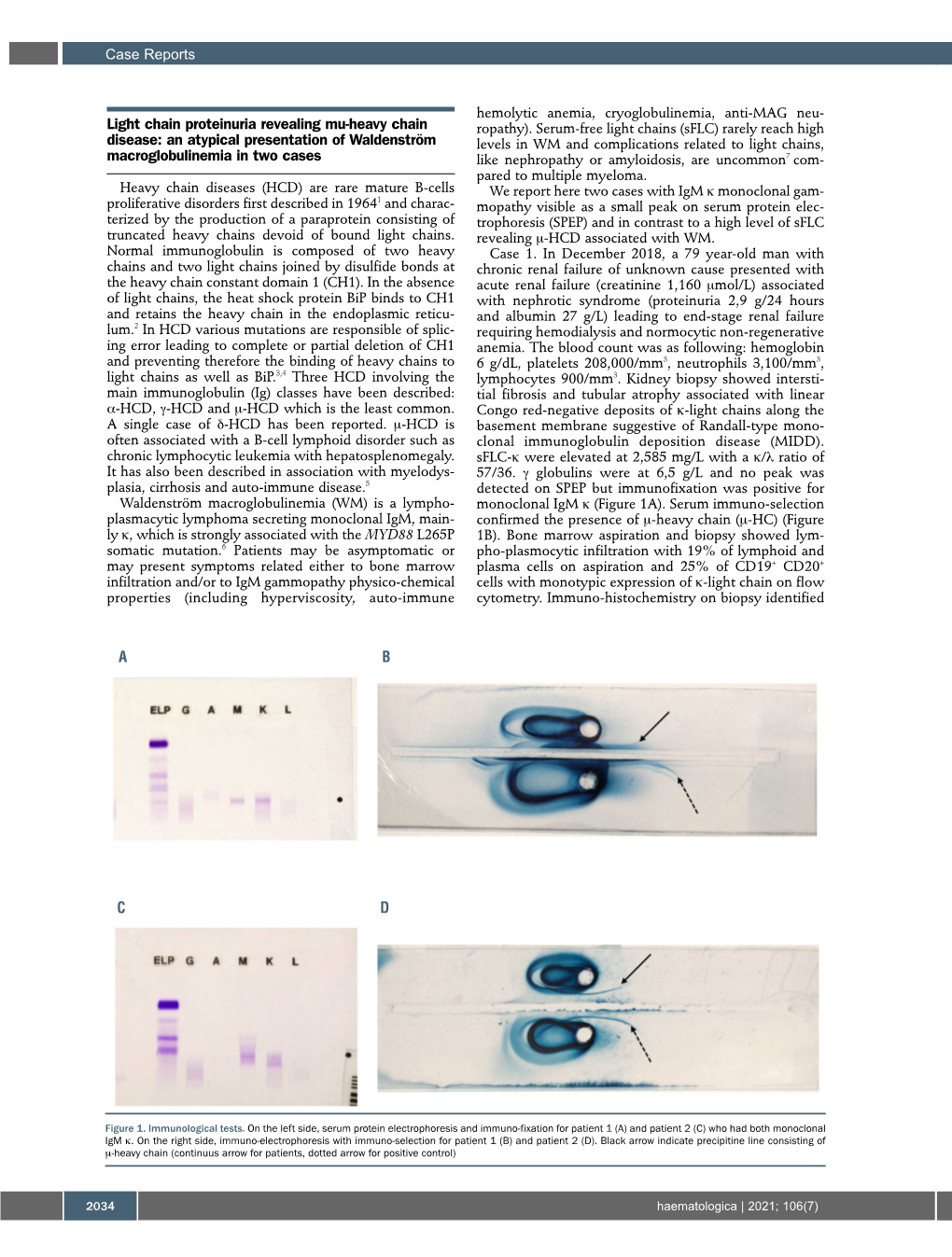 Light Chain Proteinuria Revealing Mu-Heavy Chain Disease